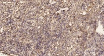 TIS11B (phospho Ser92) rabbit pAb Antibody