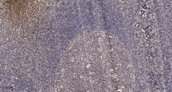 Stat2 (phospho Tyr631) rabbit pAb Antibody