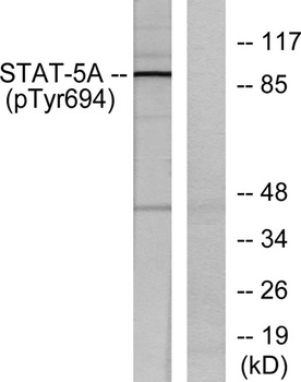 Stat5 (phospho Tyr694/699) rabbit pAb Antibody