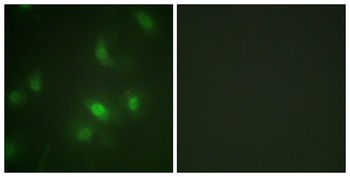 Stat5a/b (phospho Ser726/731) rabbit pAb Antibody