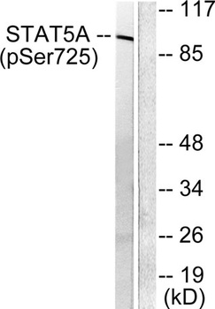 Stat5a/b (phospho Ser726/731) rabbit pAb Antibody