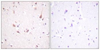 Krs-1/2 rabbit pAb Antibody