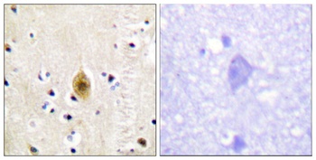 Krs-1/2 (phospho Thr183) rabbit pAb