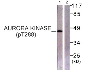 ARK-1 (phospho Thr288) rabbit pAb Antibody