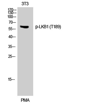 LKB1 (phospho Thr189) rabbit pAb Antibody