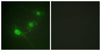 LKB1 (phospho Ser428) rabbit pAb Antibody