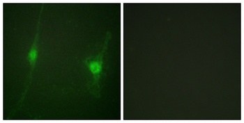 LKB1 rabbit pAb Antibody