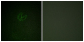 Syk (phospho Tyr323) rabbit pAb Antibody