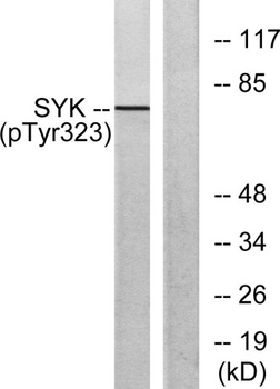 Syk (phospho Tyr323) rabbit pAb Antibody