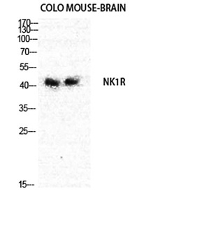 NK-1R rabbit pAb Antibody