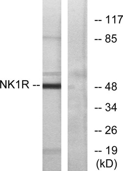 NK-1R rabbit pAb Antibody