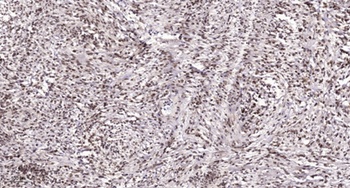TAF II p135/p105 rabbit pAb Antibody