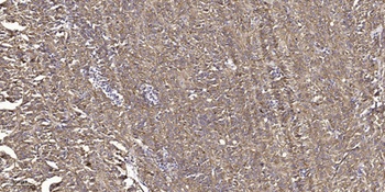 Tak1 (phospho Thr184) rabbit pAb