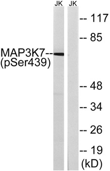 Tak1 (phospho Ser439) rabbit pAb