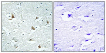 Mlx rabbit pAb Antibody