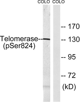 TERT (phospho Ser824) rabbit pAb Antibody
