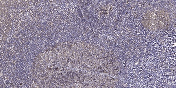 TERT (phospho Ser824) rabbit pAb Antibody