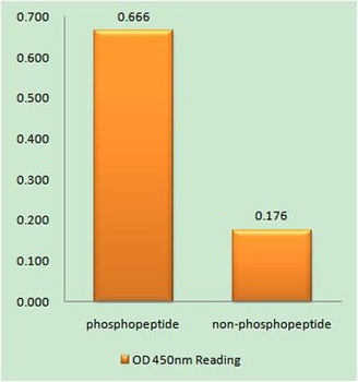 TERT (phospho Ser227) rabbit pAb Antibody