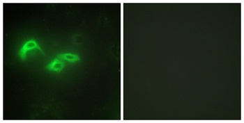 mtTFA rabbit pAb Antibody