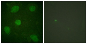 Hic-5 rabbit pAb Antibody