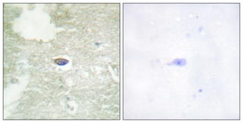TGFβ RII (phospho Ser225) rabbit pAb