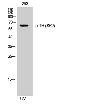TH (phospho Ser62) rabbit pAb