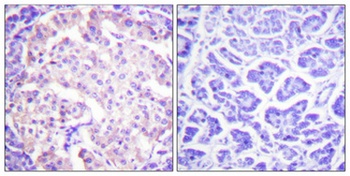 TH (phospho Ser62) rabbit pAb