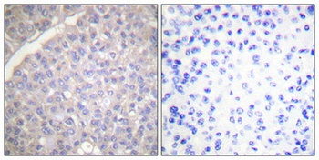 Tyrosine Hydroxylase rabbit pAb