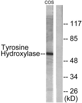 Tyrosine Hydroxylase rabbit pAb
