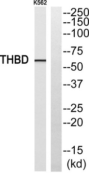 CD141 rabbit pAb Antibody