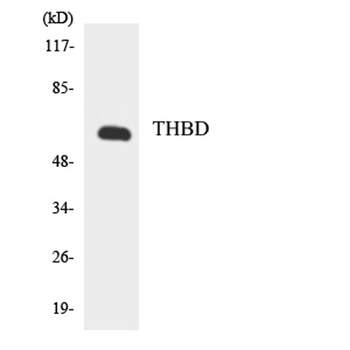 CD141 rabbit pAb Antibody