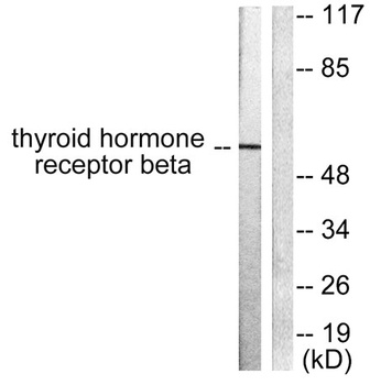 TRβ1 rabbit pAb Antibody