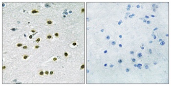 TIEG-1/2 rabbit pAb Antibody