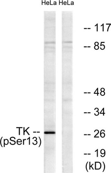 Thymidine Kinase (phospho Ser13) rabbit pAb Antibody