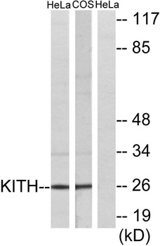 Thymidine Kinase rabbit pAb Antibody