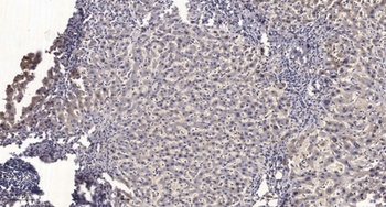 Thymidine Kinase rabbit pAb Antibody