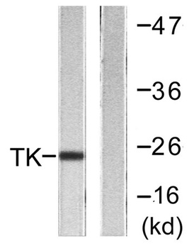 Thymidine Kinase rabbit pAb Antibody