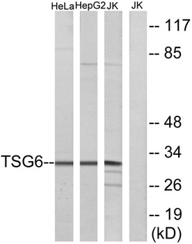 TSG-6 rabbit pAb Antibody
