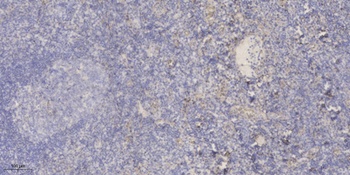 TSG-6 rabbit pAb Antibody
