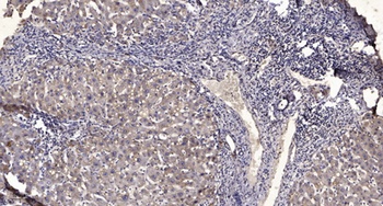 Troponin I-C (phospho Thr142) rabbit pAb Antibody