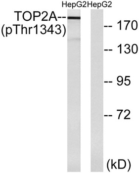 Topo IIα (phospho Thr1343) rabbit pAb Antibody