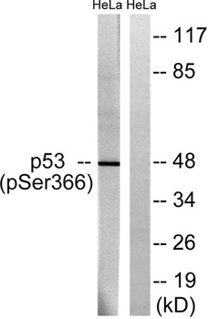 p53 (phospho Ser366) rabbit pAb Antibody