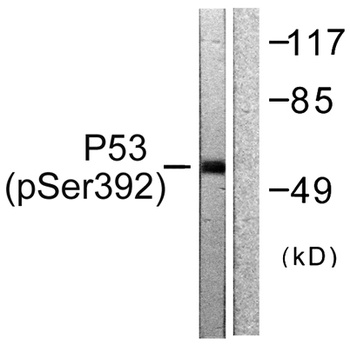 p53 (phospho Ser392) rabbit pAb Antibody