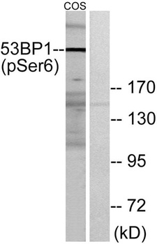53BP1 (phospho Ser6) rabbit pAb Antibody