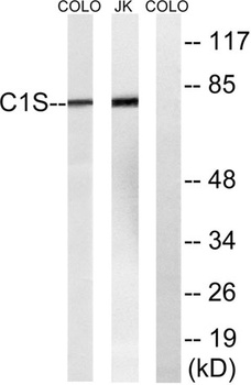C1s rabbit pAb Antibody