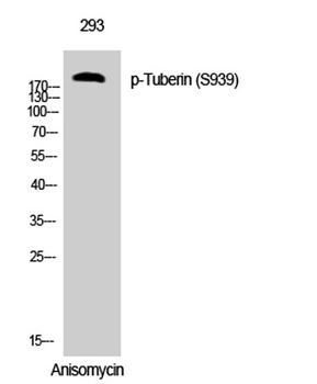 Tuberin (phospho Ser939) rabbit pAb Antibody