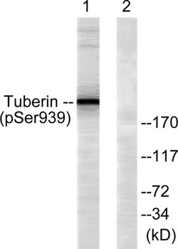 Tuberin (phospho Ser939) rabbit pAb Antibody