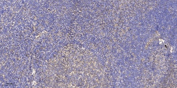 UBE2G1 rabbit pAb Antibody