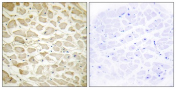 COL14A1 rabbit pAb Antibody