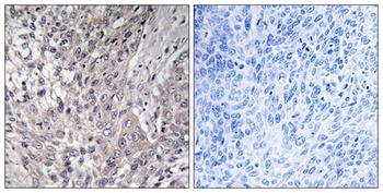 VASP (phospho Ser157) rabbit pAb Antibody